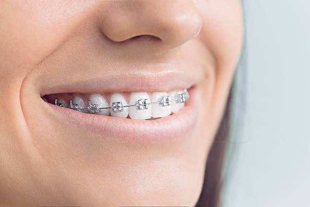 Best Veneers and Lumineers  in Big Rock, IL
